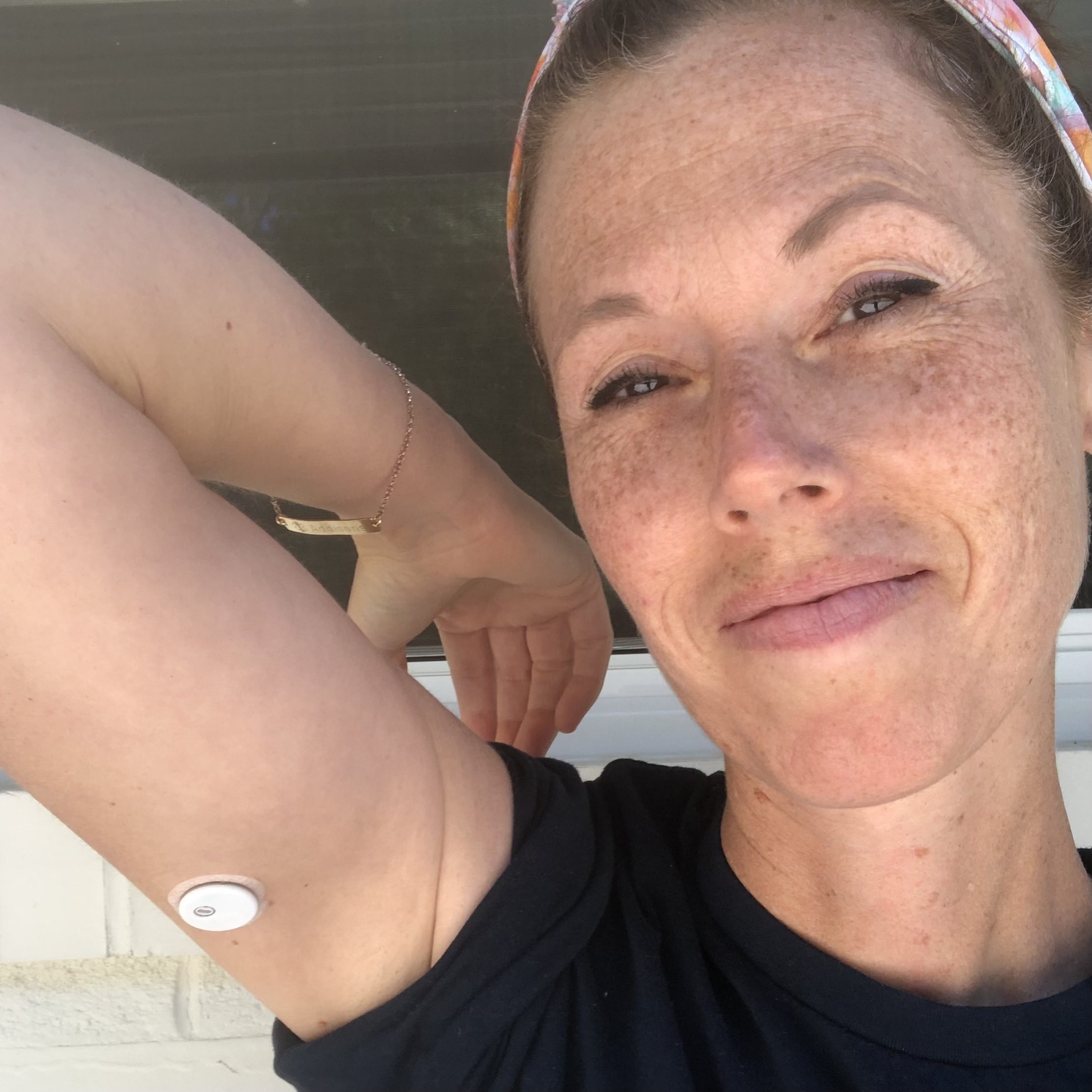 The Value of a Continuous Glucose Monitor